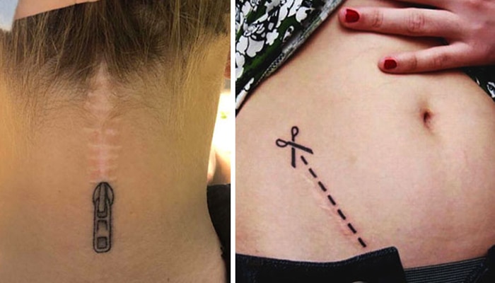 tatuajes cicatrices