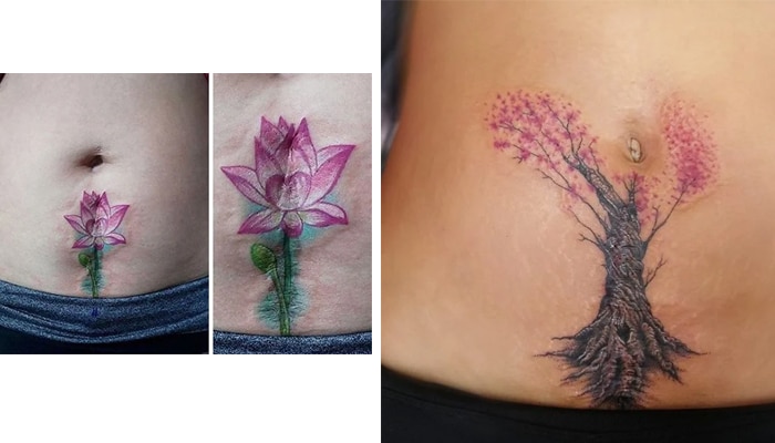 tatuajes cicatrices