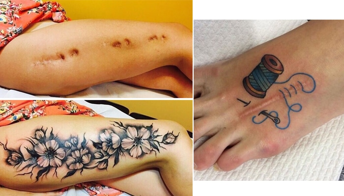 tatuajes de cicatrices