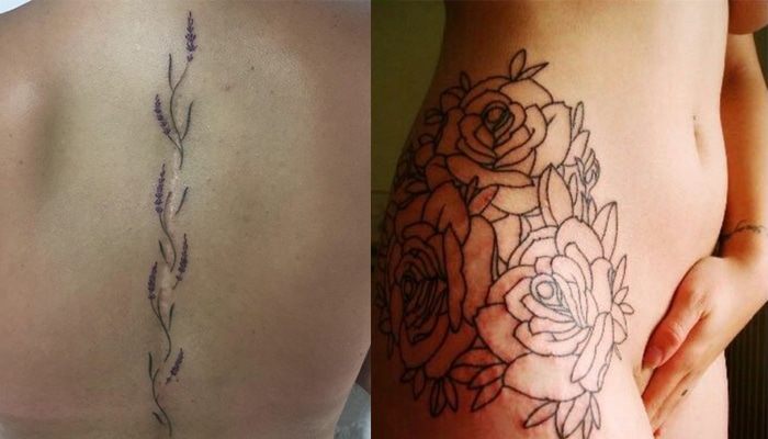 tatuajes cicatrices