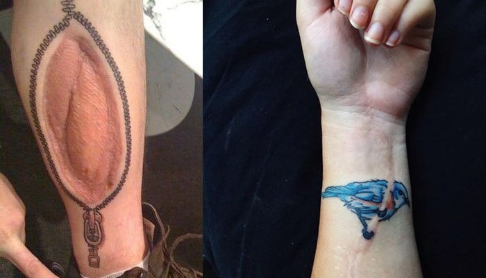 tatuajes cicatrices