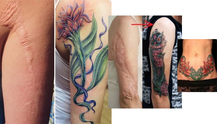 tatuajes cicatrices