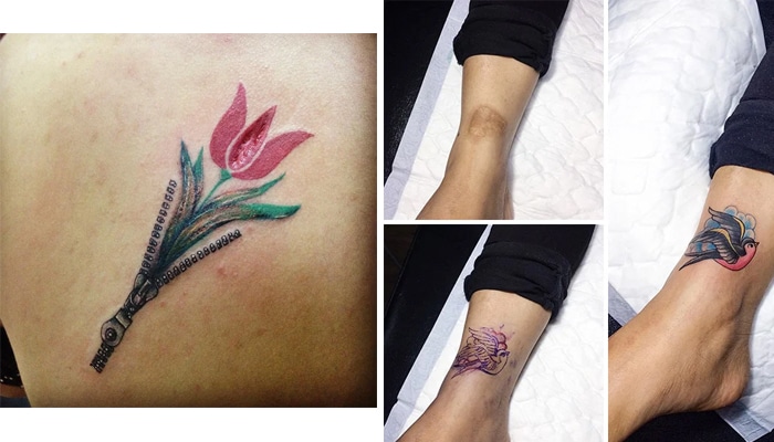 tatuajes cicatrices