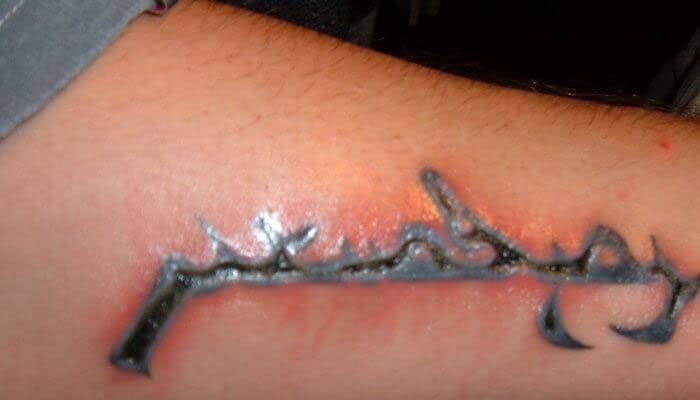 curar tatuajes infectados